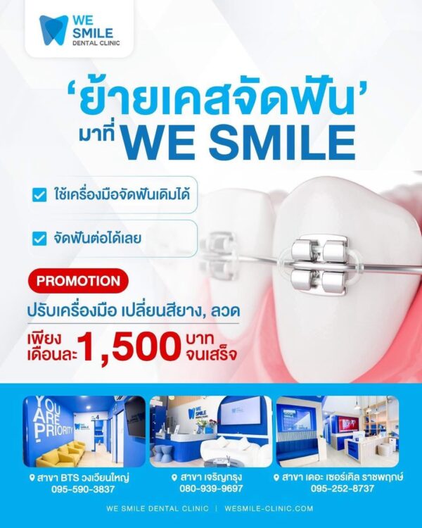 โปรโมชั่นย้ายเคสจัดฟันโลหะมาที่ We Smile ปรับเครื่องมือเดือนละ 1,500 บาท
