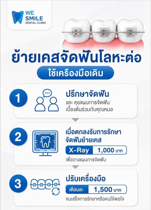 ขั้นตอนย้ายเคสจัดฟันโลหะ ใช้เครื่องมือเดิม X-Ray 1,000 บาท ปรับเครื่องมือเดือนละ 1,500 บาท