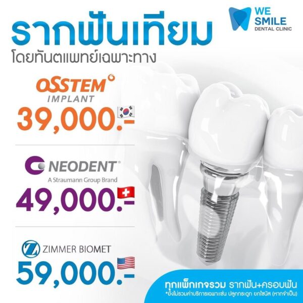 โปรโมชั่นรากฟันเทียม Osstem 39,000 Neodent 49,000 และ Zimmer Biomet 59,000 บาท