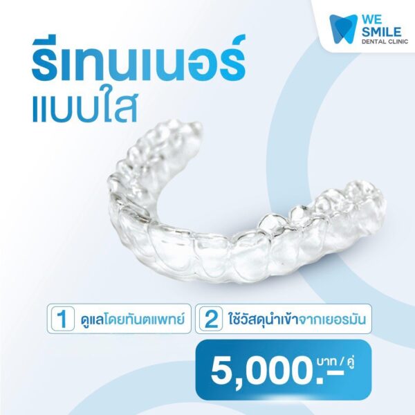 รีเทนเนอร์แบบใส ราคา 5,000 บาทต่อคู่