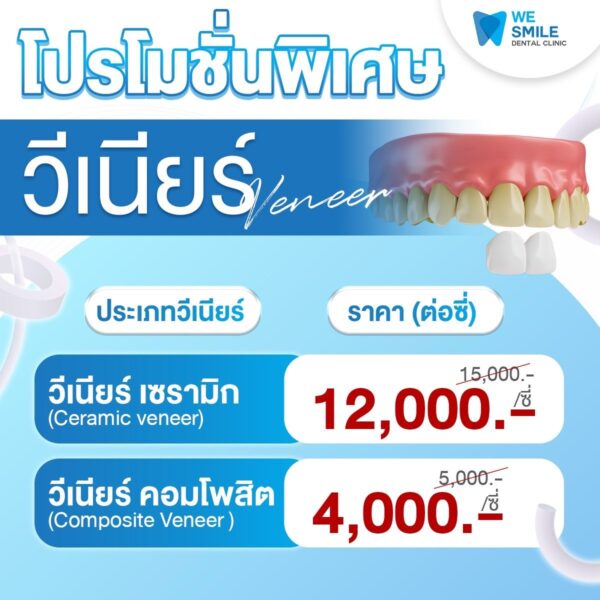 โปรโมชั่นวีเนียร์เซรามิก 12,000 บาทต่อซี่ และวีเนียร์คอมโพสิต 4,000 บาทต่อซี่