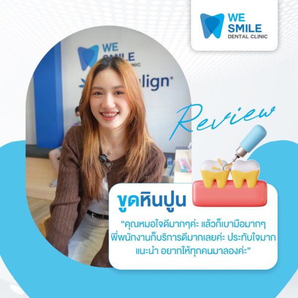 รีวิวจากคนไข้ขูดหินปูน 2