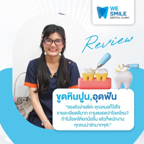 รีวิวจากคนไข้ขูดหินปูนและอุดฟัน