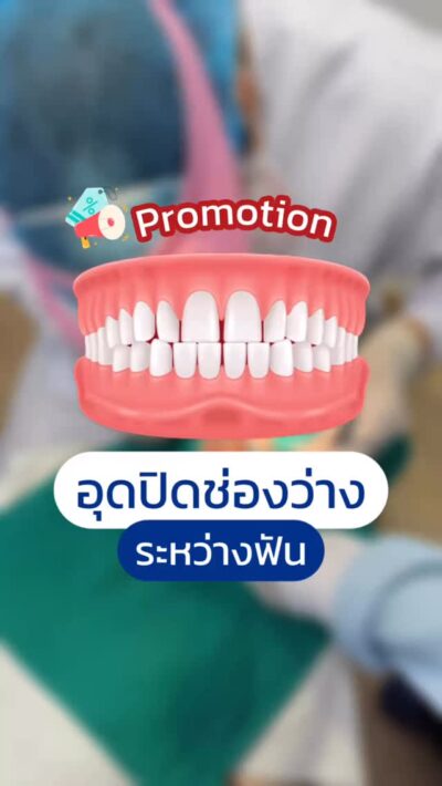 ฟันห่าง แก้ด้วยการอุดปิดช่องว่าง