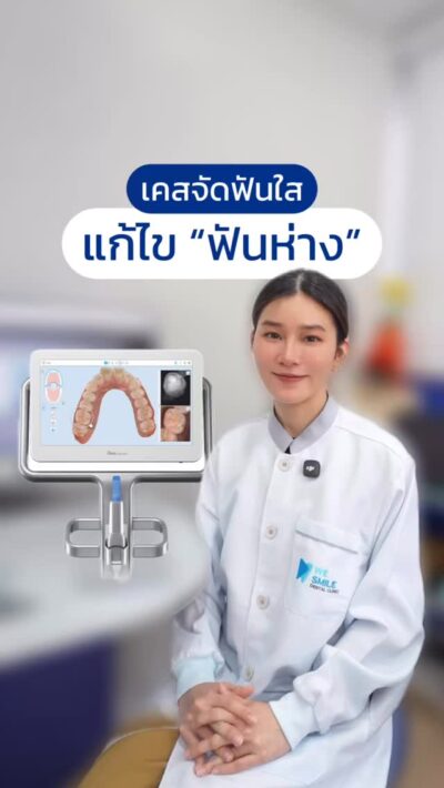 ฟันห่าง แก้ได้ใน 10 เดือน ด้วย Invisalign Essentials