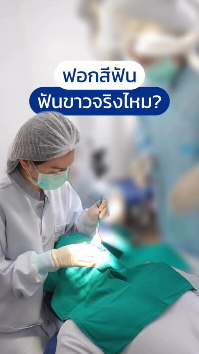 ผลลัพธ์ฟอกสีฟัน Cool Light (Pola Whitening)