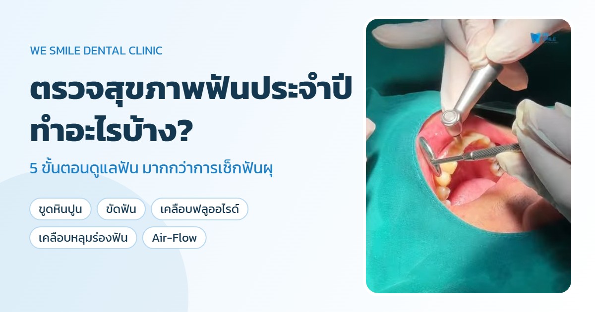 ตรวจสุขภาพฟันประจำปี ทำอะไรบ้าง — We Smile Dental Clinic