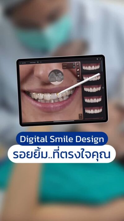 Digital Smile Design รอยยิ้มที่ตรงใจคุณ