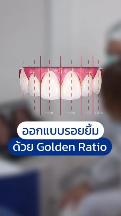 ออกแบบรอยยิ้มด้วย Golden Ratio