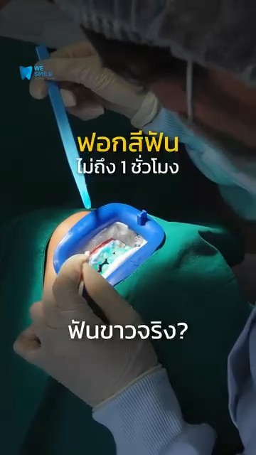 ฟอกสีฟันไม่ถึง 1 ชั่วโมง ฟันขาวจริงไหม