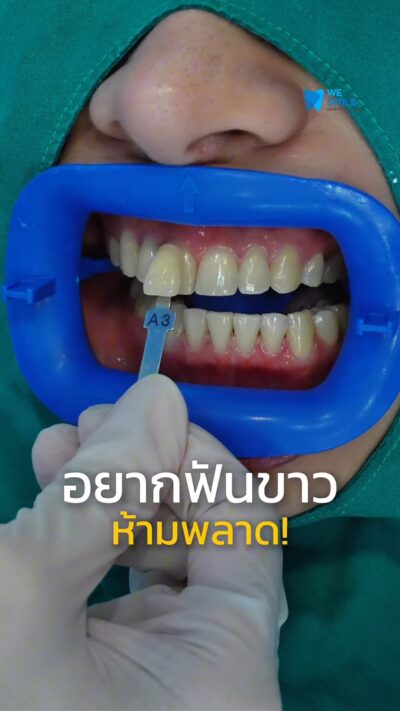 ฟอกสีฟัน Philips Zoom ที่ We Smile